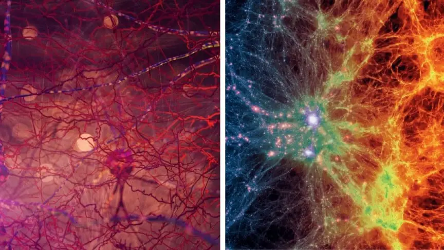 CAN THE UNIVERSE BE THE BRAIN OF SOMEONE?
